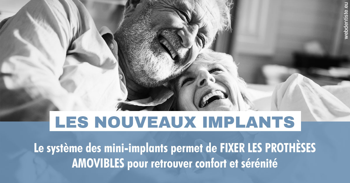 https://selarl-urpo.chirurgiens-dentistes.fr/Les nouveaux implants 2