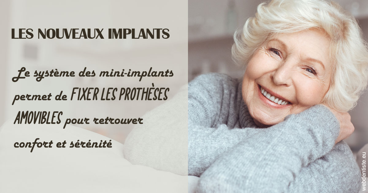 https://selarl-urpo.chirurgiens-dentistes.fr/Les nouveaux implants 1