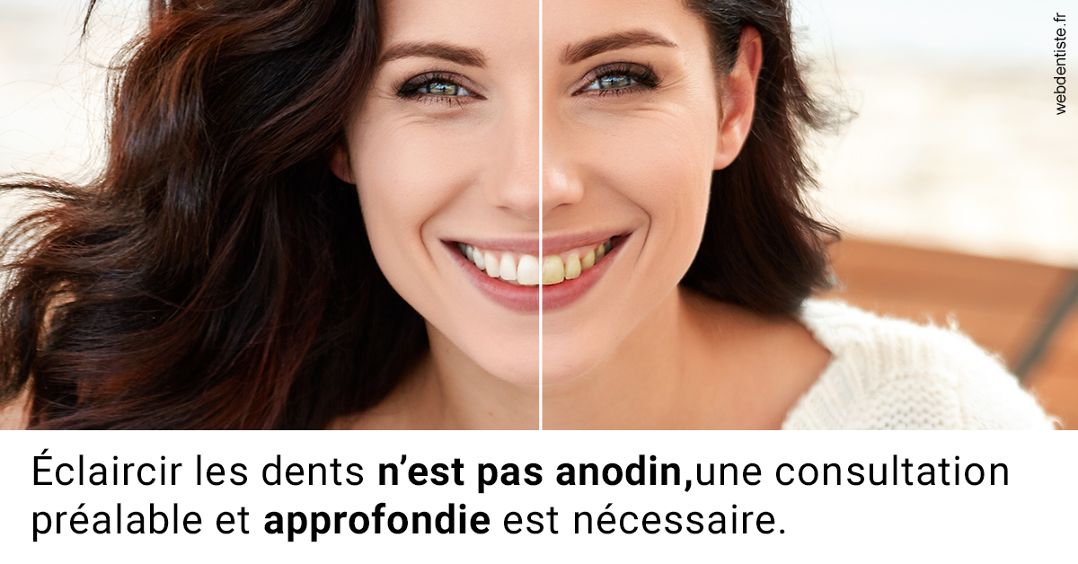 https://selarl-urpo.chirurgiens-dentistes.fr/Le blanchiment 2