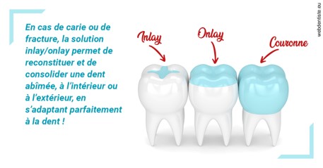 https://selarl-urpo.chirurgiens-dentistes.fr/L'INLAY ou l'ONLAY