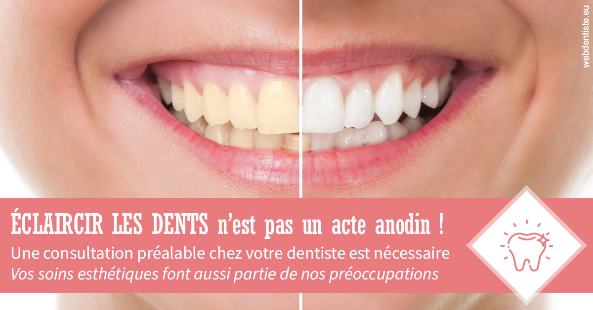 https://selarl-urpo.chirurgiens-dentistes.fr/Eclaircir les dents 1