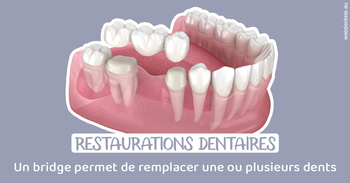 https://selarl-urpo.chirurgiens-dentistes.fr/Bridge remplacer dents 1