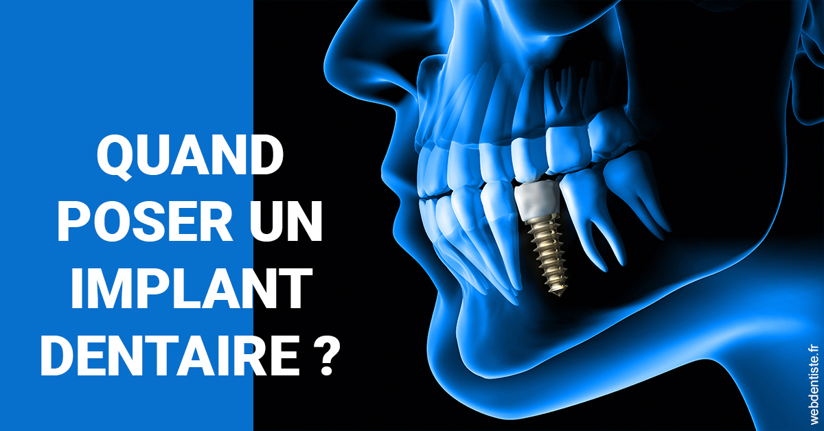 https://selarl-urpo.chirurgiens-dentistes.fr/Les implants 1