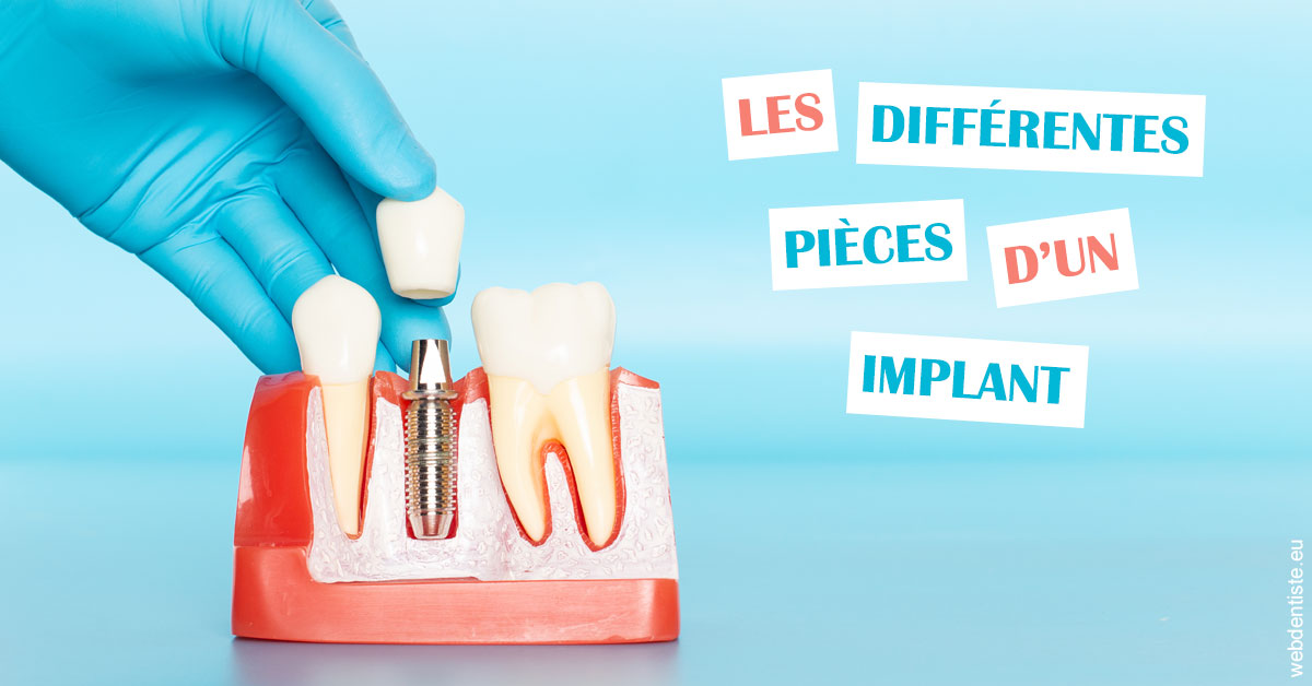 https://selarl-urpo.chirurgiens-dentistes.fr/Les différentes pièces d’un implant 2