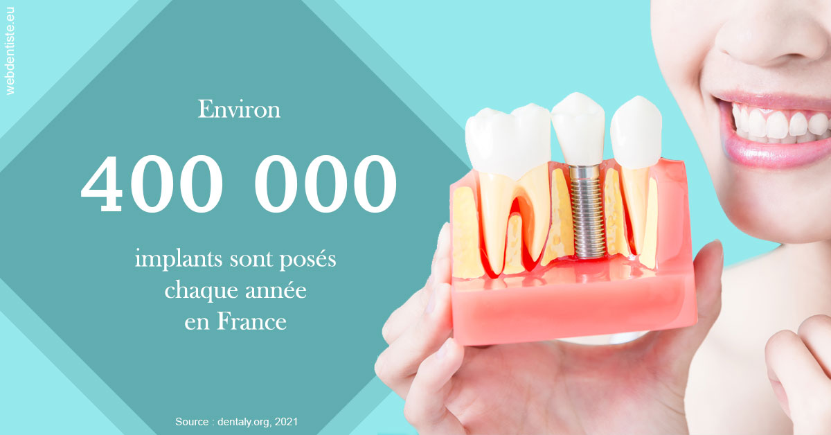 https://selarl-urpo.chirurgiens-dentistes.fr/Pose d'implants en France 2