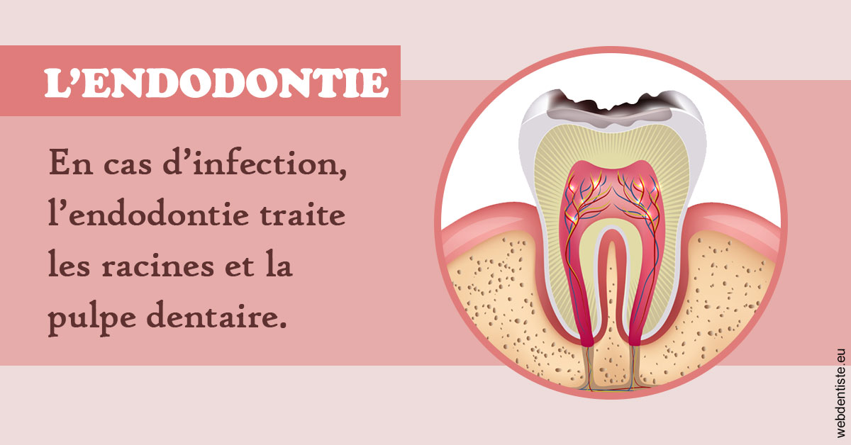 https://selarl-urpo.chirurgiens-dentistes.fr/L'endodontie 2